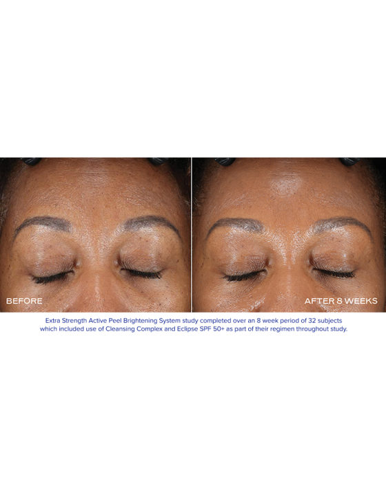 EXTRA STRENGTH ACTIVE PEEL BRIGHTENING SYSTEM