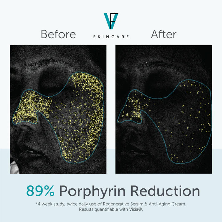 Regenerative Serum
