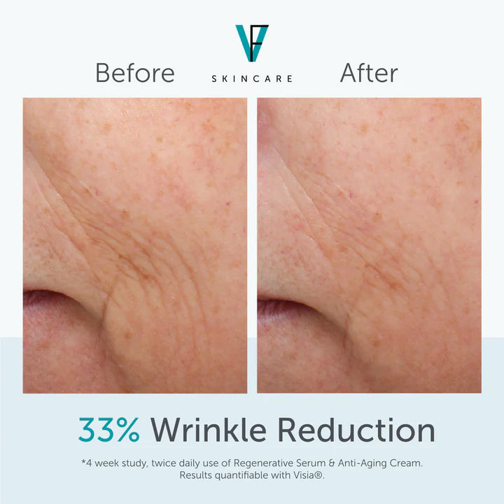 Anti-Aging Cream