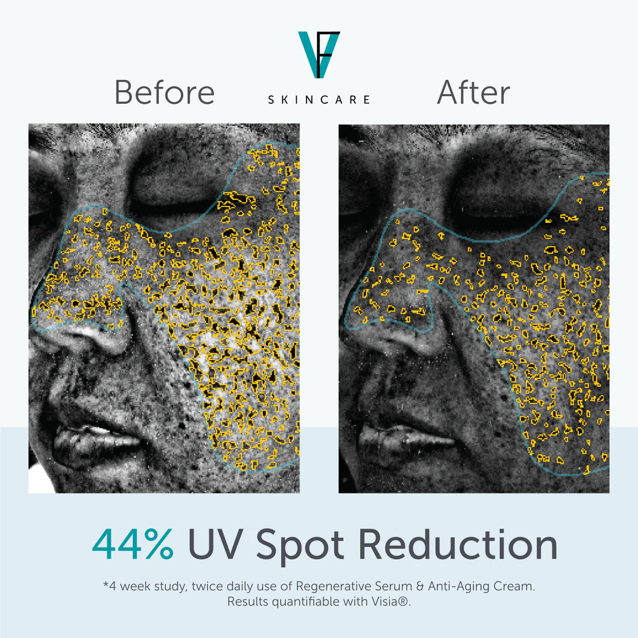 Anti-Aging Cream