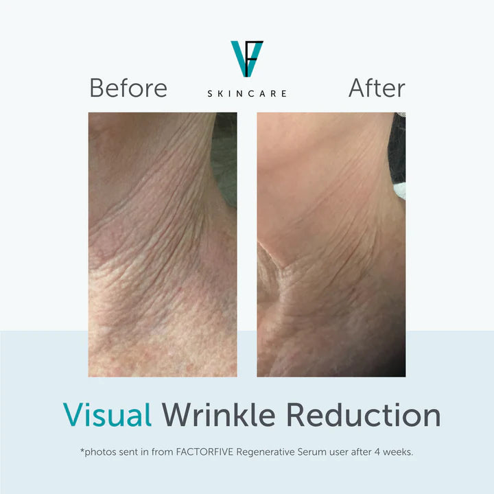 Regenerative Serum