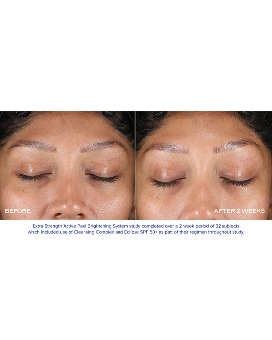 EXTRA STRENGTH ACTIVE PEEL BRIGHTENING SYSTEM